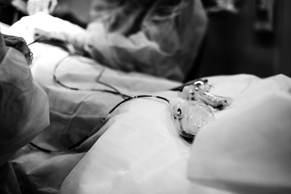 hip surgery